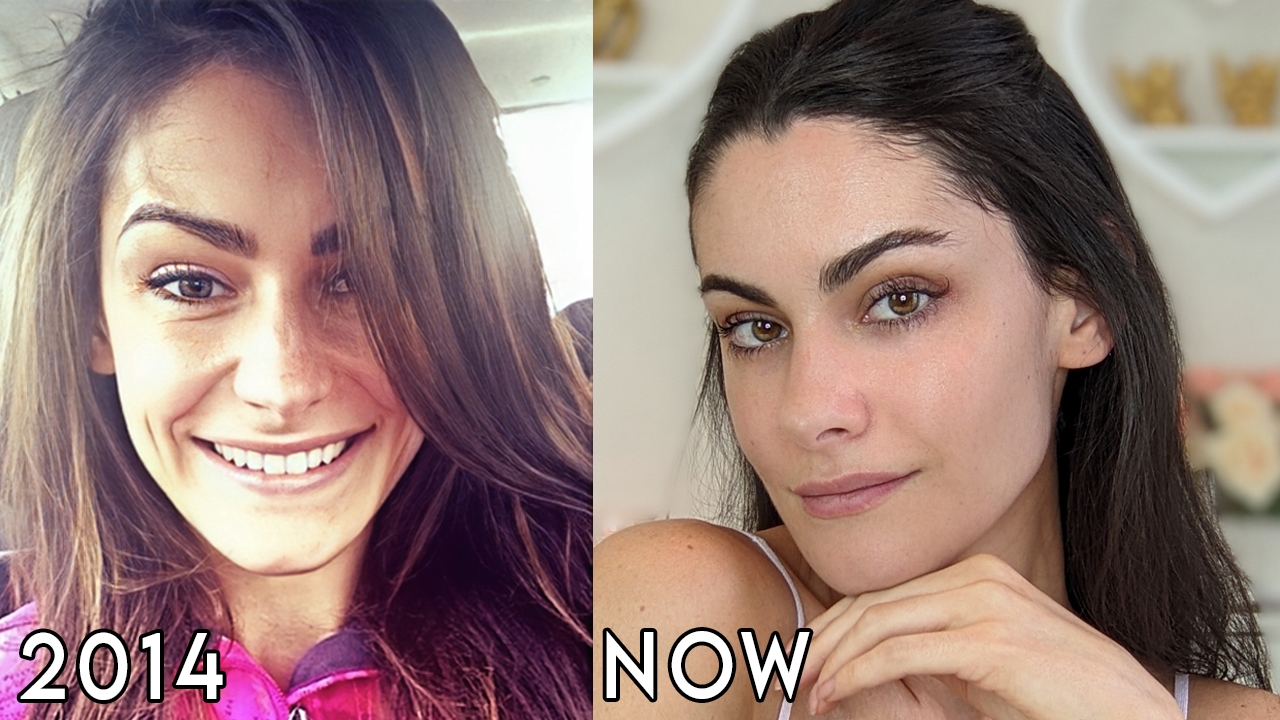 Reverse Aging – How I Did It